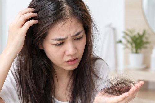 Viêm da tiết bã có gây rụng tóc?