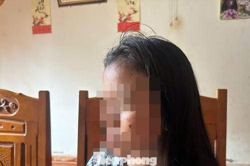 Nữ sinh lớp 10 bị bắt quỳ, túm tóc, dí thuốc sát mặt: Chuyện gì xảy ra phía sau clip?