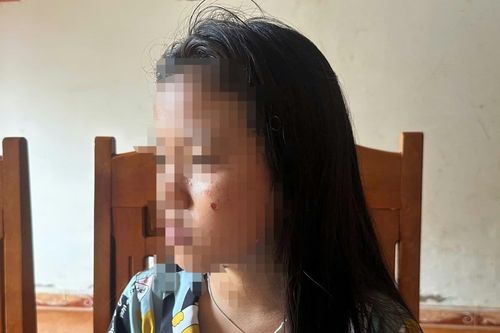 Vụ nữ sinh lớp 10 bị đánh, dí thuốc vào mặt ở Đắk Lắk: Nạn nhân không dám đi học