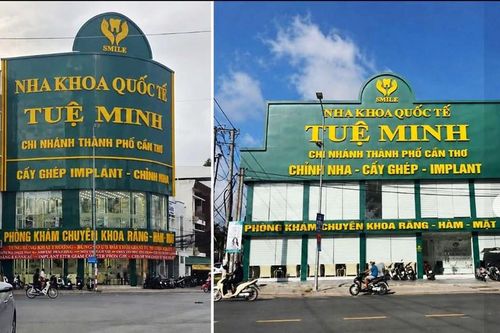 Cần Thơ: Xử phạt hệ thống Nha khoa Quốc tế Tuệ Minh 456 triệu đồng