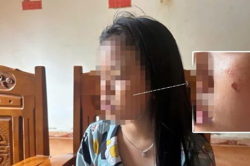 Nữ sinh lớp 10 ở Đắk Lắk lên tiếng về nguyên nhân bị bạn hành hung