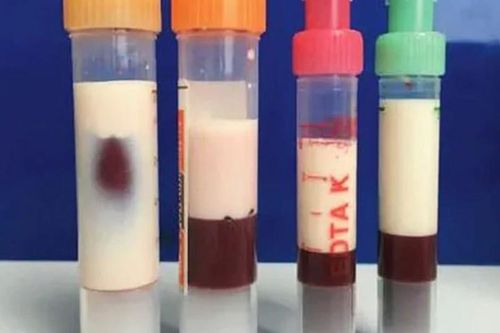 Bé gái 12 tuổi máu 'trắng đục như sữa' vì thường xuyên ăn món quen thuộc 'vạn người mê'