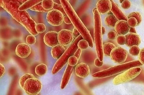 Ca tử vong do viêm phổi chưa rõ nguyên nhân ở Nga: Bộ Y tế khuyến cáo người dân điều gì?