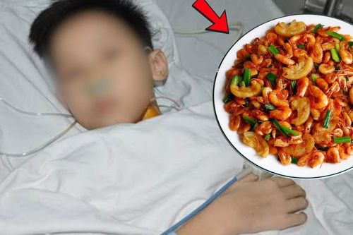 Ăn tôm đồng, bé trai 14 tuổi mẩn đỏ toàn thân nhập viện nguy kịch