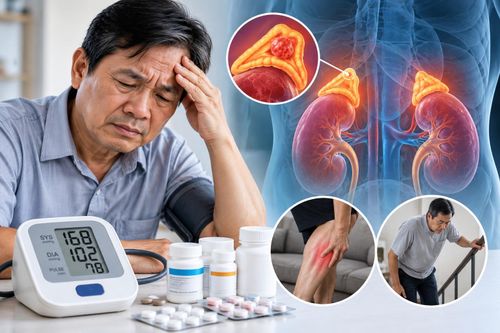 Vì sao uống 3-4 loại thuốc huyết áp mỗi ngày nhưng chỉ số vẫn cao?