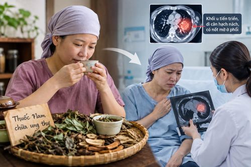 Bỏ phác đồ của bác sĩ để uống thuốc Nam chữa ung thư, 6 tháng sau đã di căn