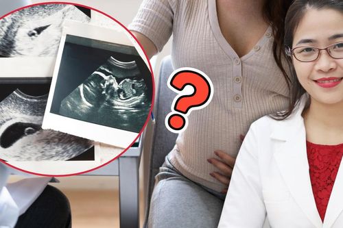Sàng lọc trước sinh: Qua mốc 12 tuần còn làm được không?
