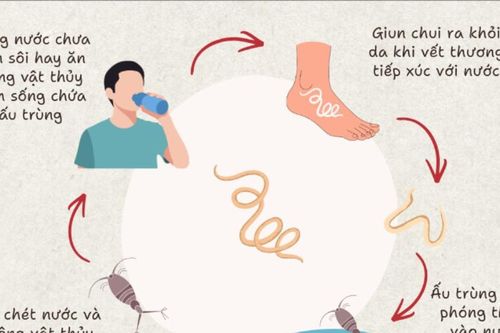 Thanh Hóa ghi nhận thêm một ca mắc bệnh giun rồng