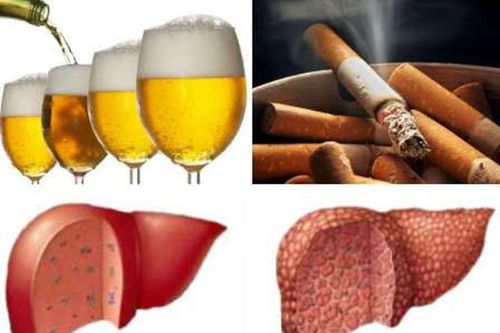 Hút thuốc lá và bệnh gan