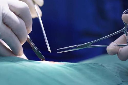 Cụ bà 74 tuổi vào viện phẫu thuật chân phải, bác sĩ cắt nhầm chân trái