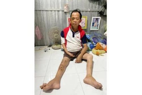 Hoàn cảnh anh Lê Hòa Bình rất cần sự chia sẻ từ cộng đồng