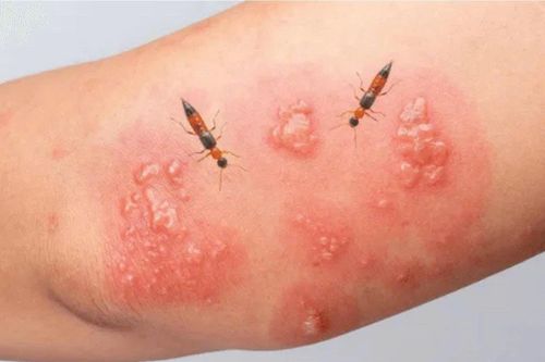 Cách hạn chế kiến ba khoang vào nhà mùa cao điểm