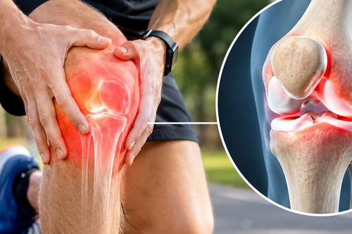 Càng đi bộ càng đau khớp gối: Sai lầm tập luyện người sau tuổi 50 không nên mắc