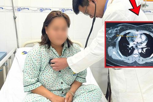 Đột ngột khó thở, cô gái 27 tuổi nhập viện phát hiện u quái trung thất