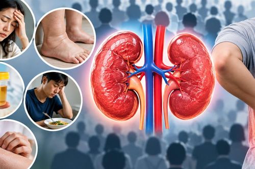 Hơn 10 triệu người Việt mắc bệnh thận: Dấu hiệu thường gặp dễ bị bỏ qua