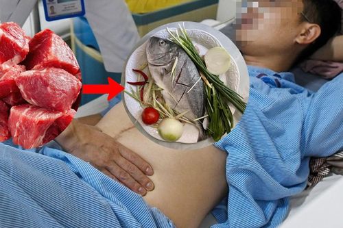 Polyp đại tràng tái phát, người đàn ông bỏ thịt ăn cá nhận kết quả bất ngờ