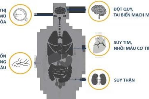 Đo huyết áp tại nhà - những điều cần lưu ý