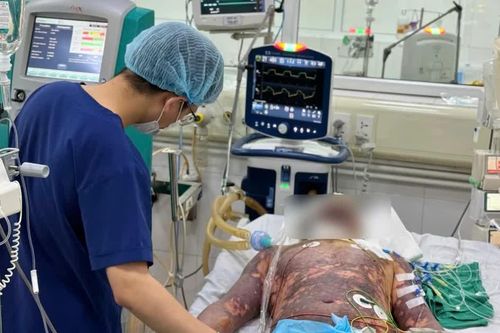 4 người nhập viện vì liên cầu lợn, có bệnh nhân nguy kịch