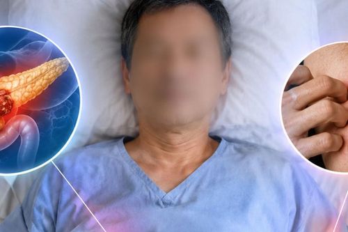 Tưởng dị ứng, người đàn ông 52 tuổi tử vong sau 6 tháng phát hiện ung thư