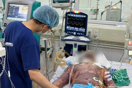 Liên tiếp 4 người mắc liên cầu lợn do ăn tiết canh, tiếp xúc lợn bệnh
