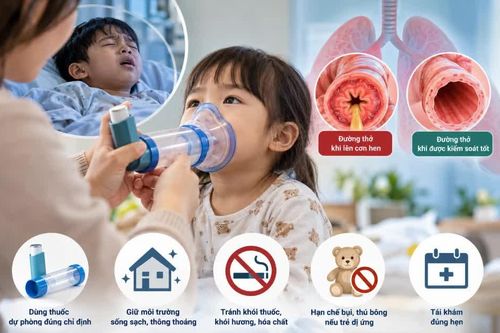Chuyên gia cảnh báo nguy hiểm khi tự ý ngừng thuốc điều trị hen cho trẻ