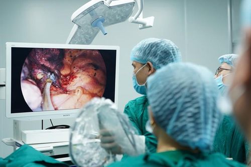 Phẫu thuật thành công 3 ca cắt kén khí màng phổi phức tạp trong một ngày