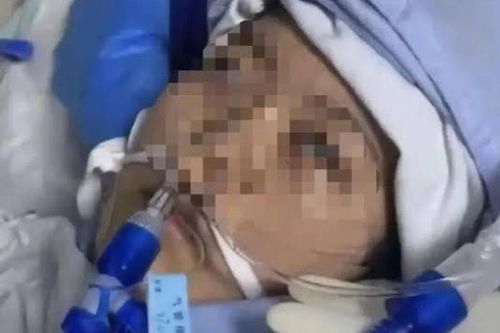 Cô gái 24 tuổi đột ngột ngừng tim sau buổi phỏng vấn xin việc: 5 dấu hiệu cảnh báo không nên bỏ qua