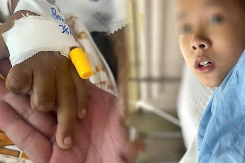 Bé trai 10 tuổi sáng đau đầu, chiều hôn mê, tối tử vong vì não mô cầu