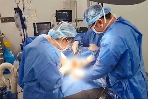 Cắt u tụy 13 cm, tái tạo mạch máu phức tạp cho người bệnh trẻ tuổi
