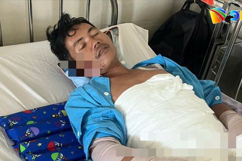Xót xa người cha 4 con bị bỏng nặng, kiệt quệ tiền điều trị