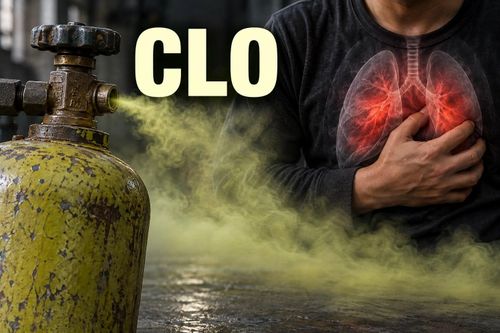 Khí clo độc hại ra sao? Bác sĩ chỉ cách nhận biết, sơ cứu