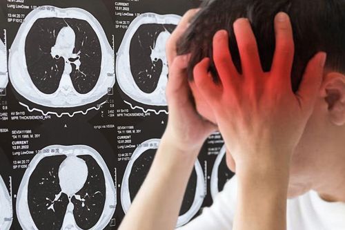 Người đàn ông đi khám vì chóng mặt, phát hiện ung thư phổi di căn nhiều nơi