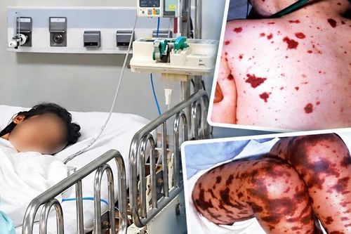 TPHCM ghi nhận ca não mô cầu mới tại xã Thường Tân