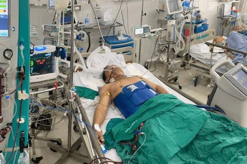 Giành sự sống cho người đàn ông 3 lần ngừng tim trong 30 phút