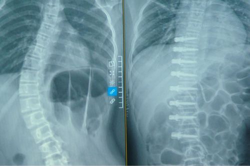Ca phẫu thuật lần đầu tiên có ở Việt Nam