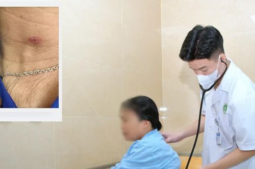 Sốt cao, đắp 3 chăn vẫn rét: Phát hiện sốt mò từ vết loét nhỏ