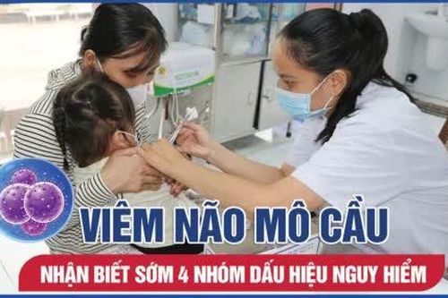 Viêm não mô cầu: 4 nhóm dấu hiệu nguy hiểm cần nhận biết sớm