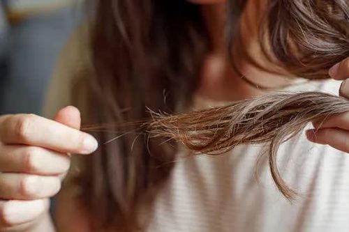 Thói quen phổ biến khiến tóc gãy rụng nhiều hơn vào mùa thu, nhiều chị em vẫn mắc mỗi ngày