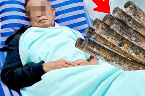 Cả nhà cùng mắc ung thư gan vì thói quen dùng đũa nhiều nhà mắc phải