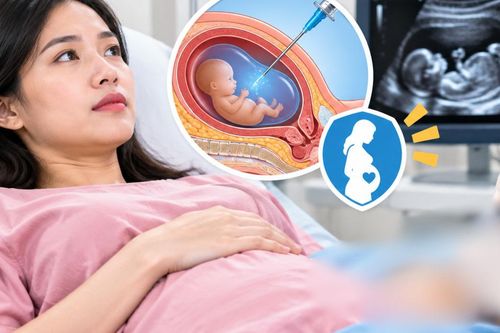 Được chỉ định chọc ối, mẹ bầu cần biết ngay những điều này
