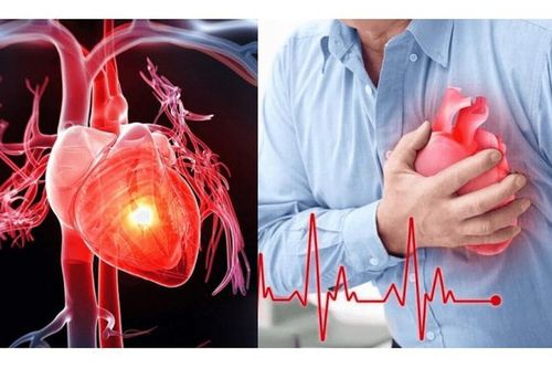 Miền Bắc chênh lệch nhiệt độ lớn trong ngày: Cách phòng ngừa sốc nhiệt và co mạch đột ngột ở người già, trẻ nhỏ