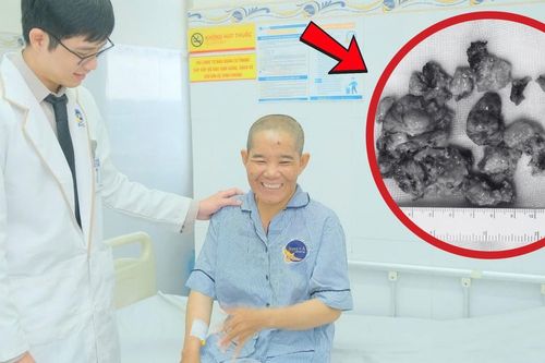 Co giật nhiều lần, người phụ nữ 41 tuổi phát hiện u não như quả trứng gà