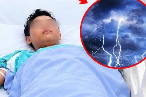 Bị sét đánh ngừng tim, thiếu niên 14 tuổi thoát cửa tử sau 30 phút cấp