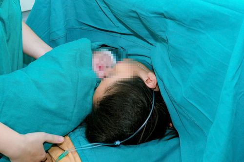 Sau 7 năm hiếm muộn và 3 lần IVF thất bại, sản phụ sinh con an toàn