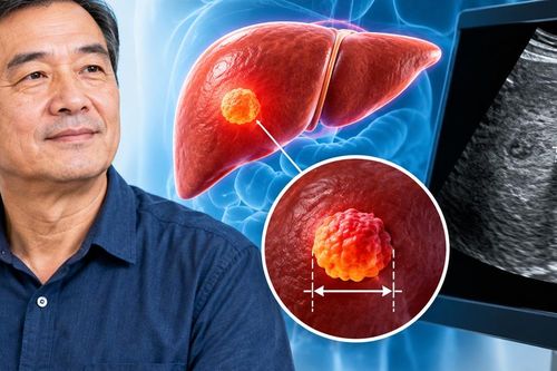 Người đàn ông không đau bụng, không vàng da vẫn phát hiện u gan gần 2 cm
