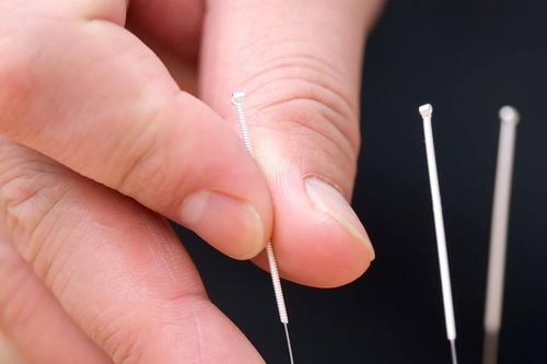 Mất ngủ nhiều năm, châm cứu bao lâu mới cải thiện?