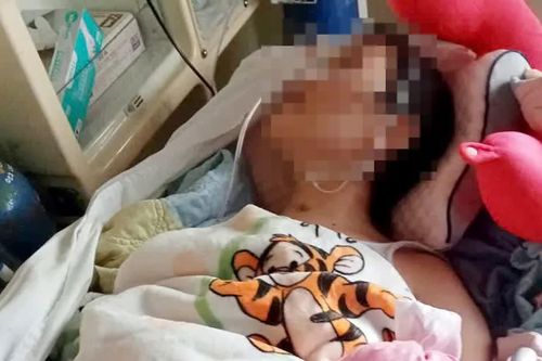 Nữ sinh tái phát tổn thương não sau tai nạn
