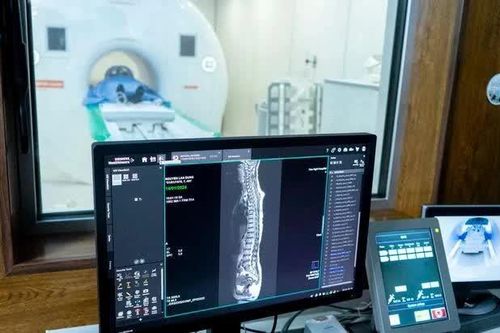 Chấn chỉnh việc 'gợi ý' người dân đi chụp cộng hưởng từ bên ngoài bệnh viện