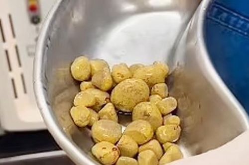 Những ai có nguy cơ bị sỏi thận cao nhất?