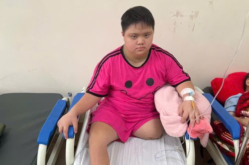 Mắc hội chứng Down, bé gái 8 tuổi lại bị ung thư xương, phải cắt bỏ một chân